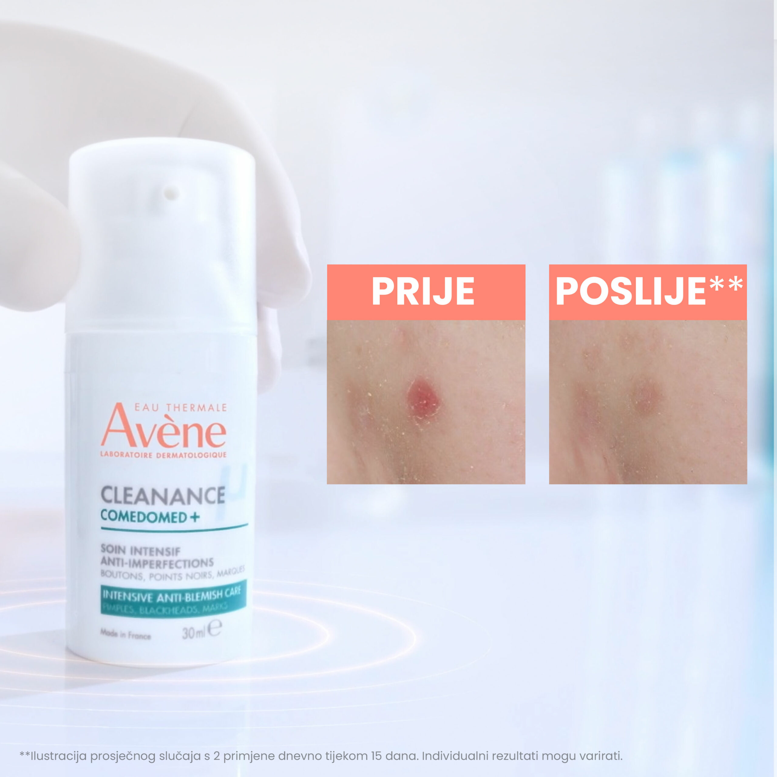 avene-cleanance-comedomed-plus-30ml-02